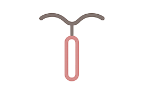 子宮内避妊器具（ミレーナ）